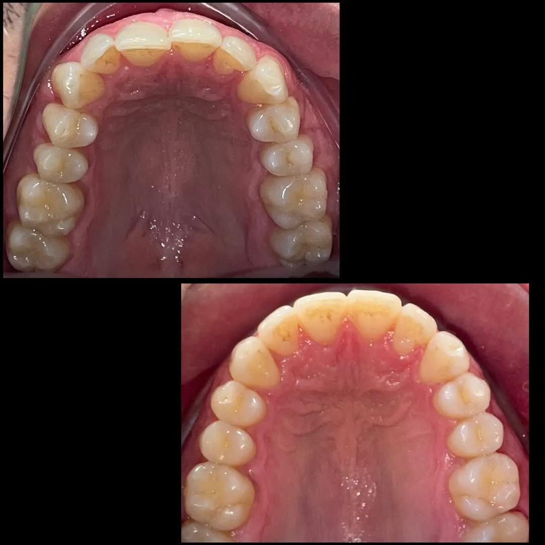 Nem sempre o paciente aparece no consultório por conta própria. Nessa caso da foto, quem trouxe (4)